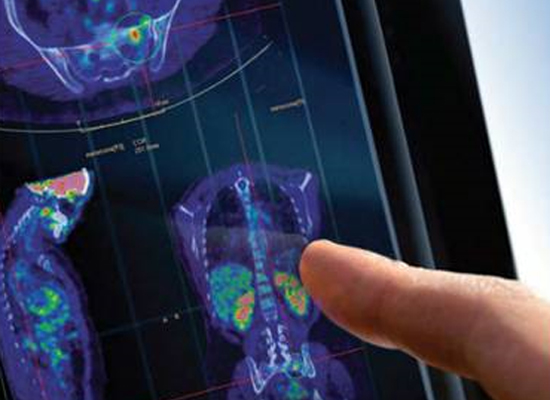 Image examens medecine nucleaire-profil medecins