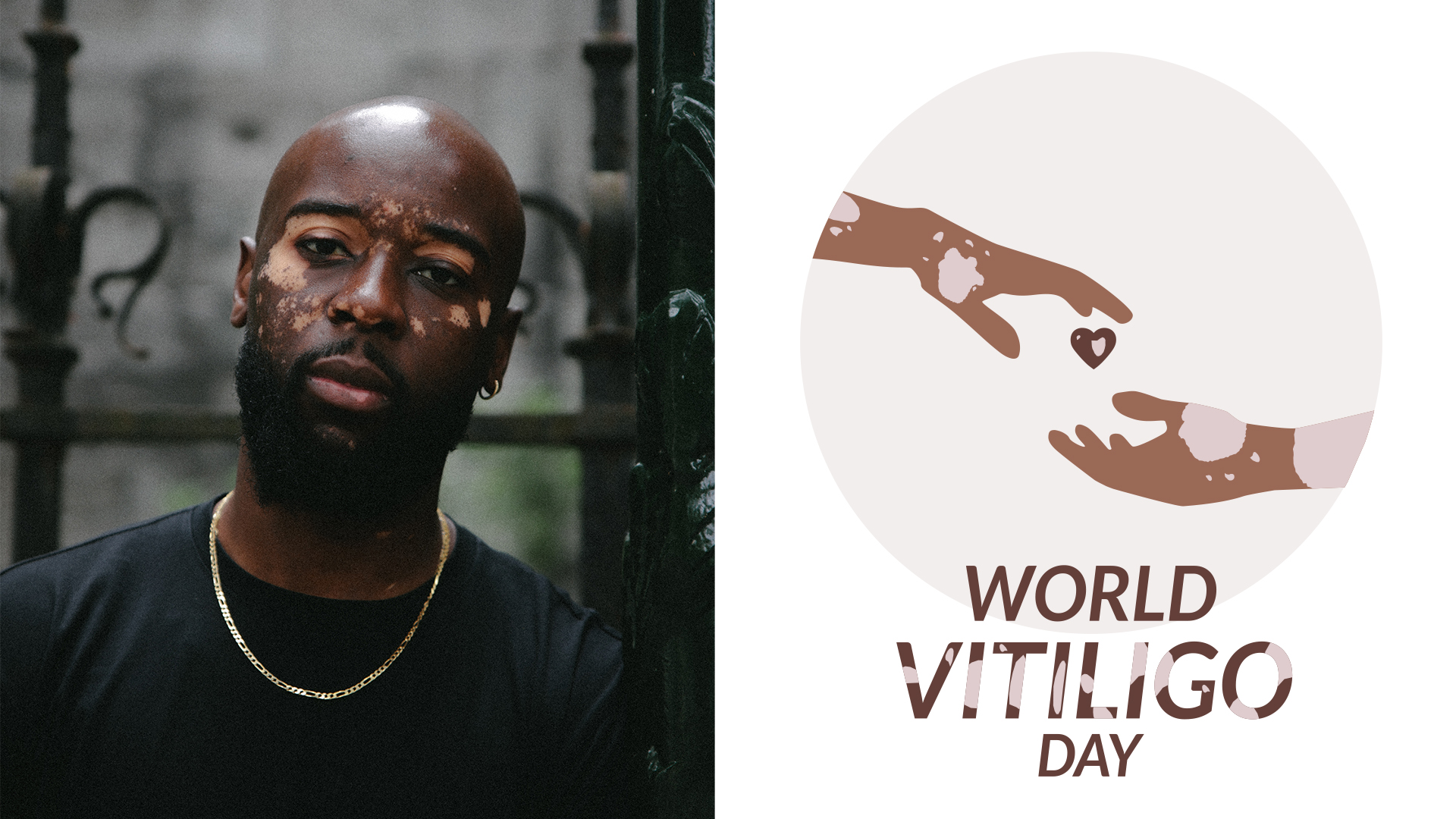 Image vitiligo campagne officielle - jordy eeke alain jones