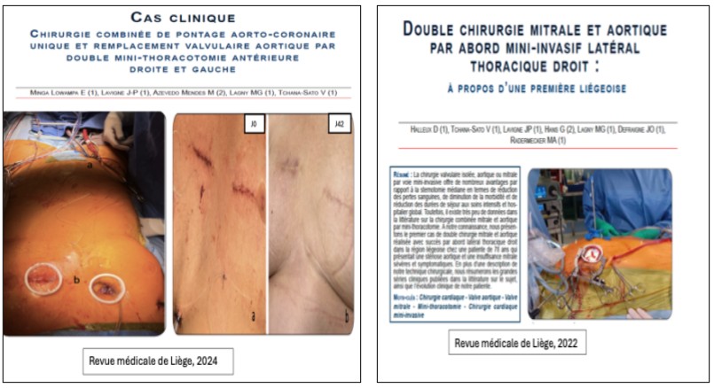 chirurgie cardiaque 4 