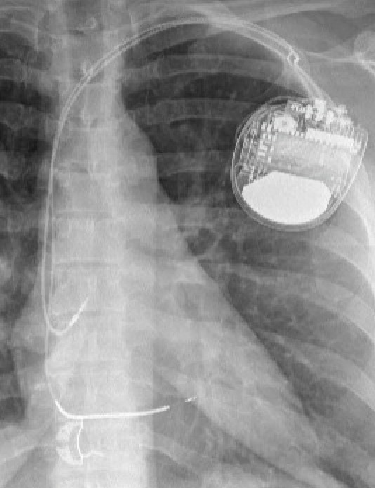 Img Nouveaute cardiologie 20260807 3