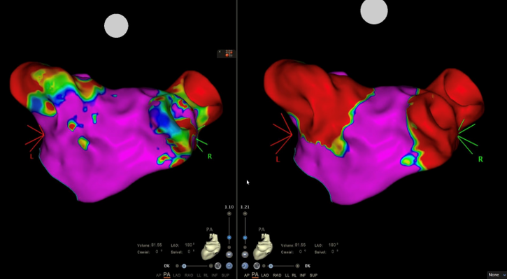 Cardiologie premiere CHU 2