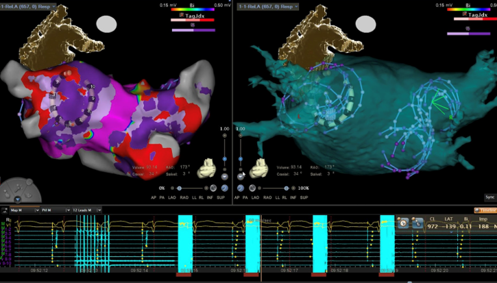 Cardiologie premiere CHU 3