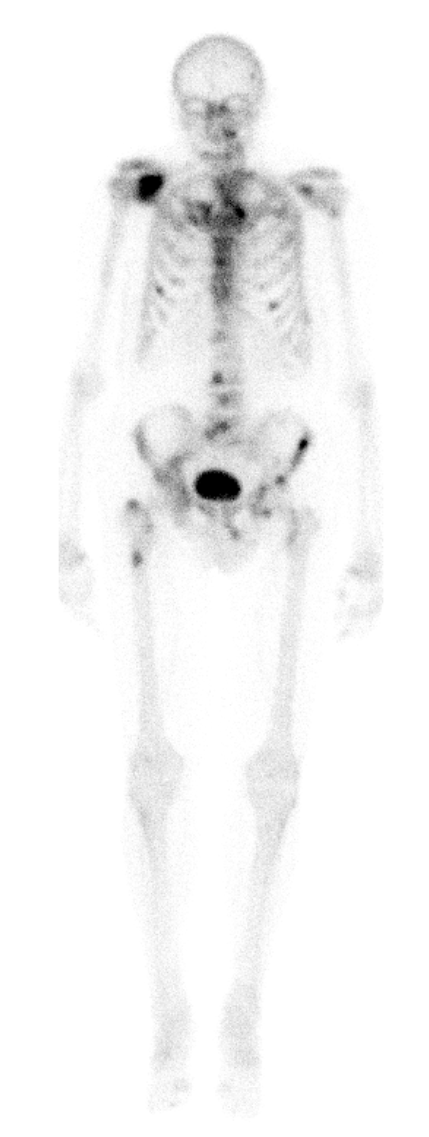Gamma caméra Médecine Nucléaire (2)