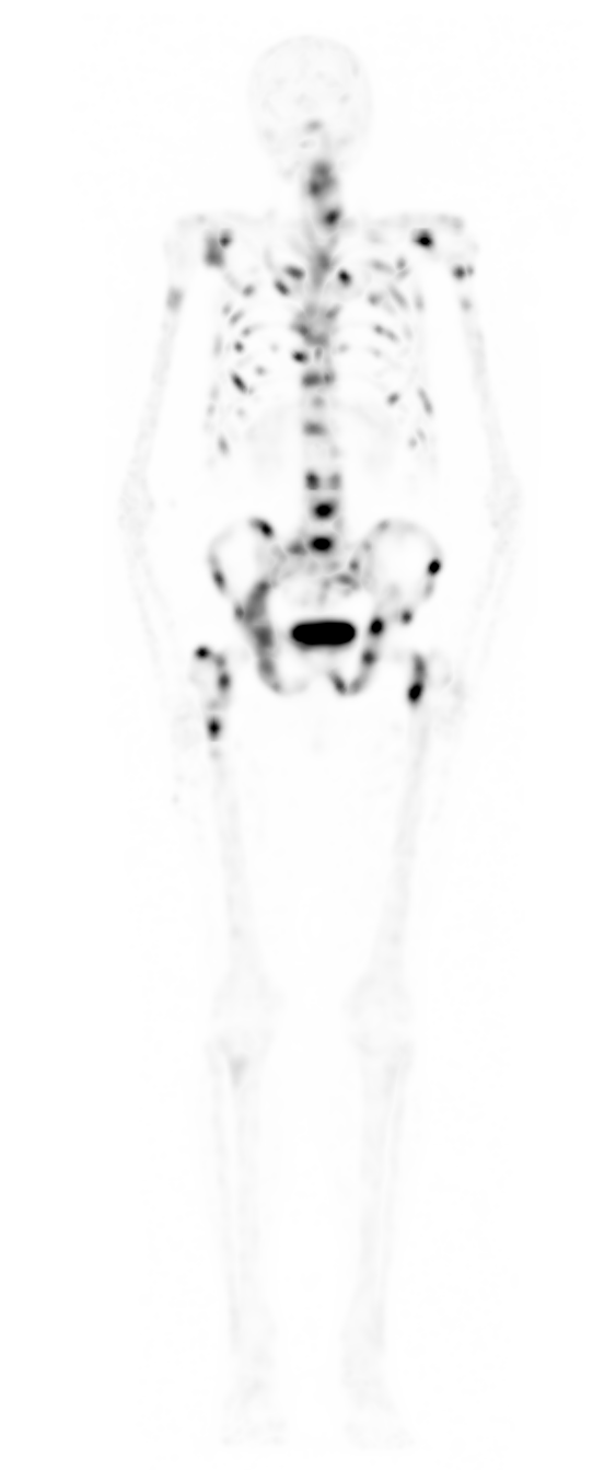 Gamma caméra Médecine Nucléaire (3)