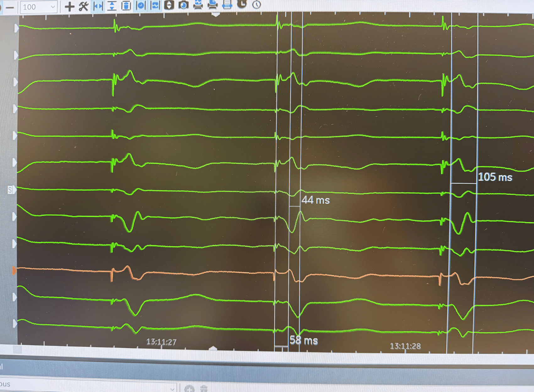 Img Nouveaute cardiologie 2