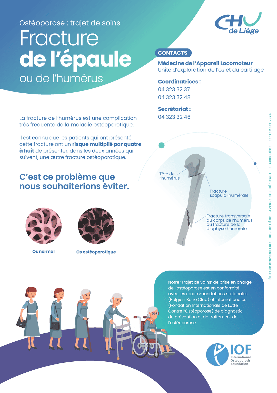 A4 MedecineAppareilLocomot Osteoporose FractureEpaule COMPRESS