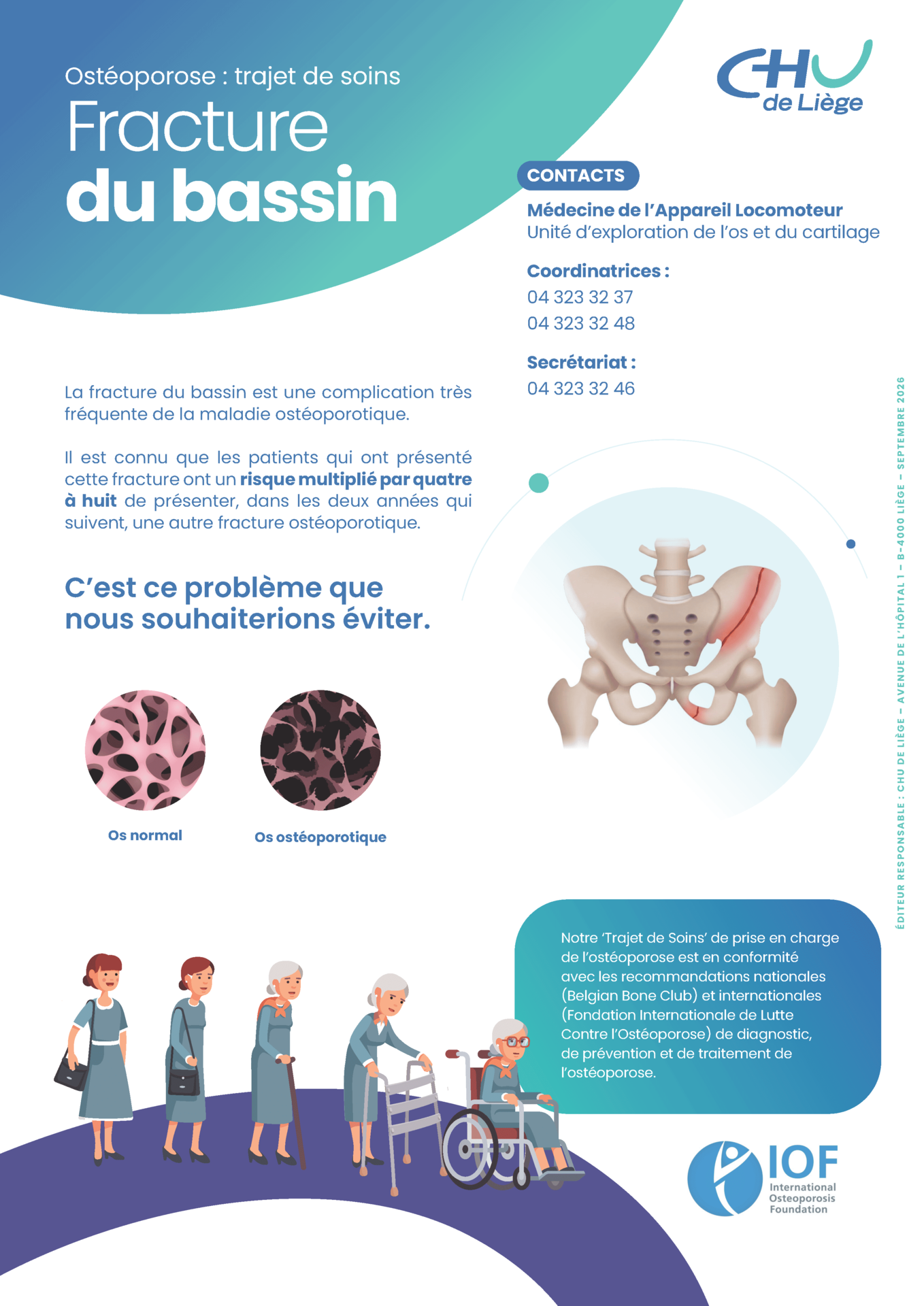 A4 MedecineAppareilLocomoteur Osteoporose FractureBassin COMPRESEES