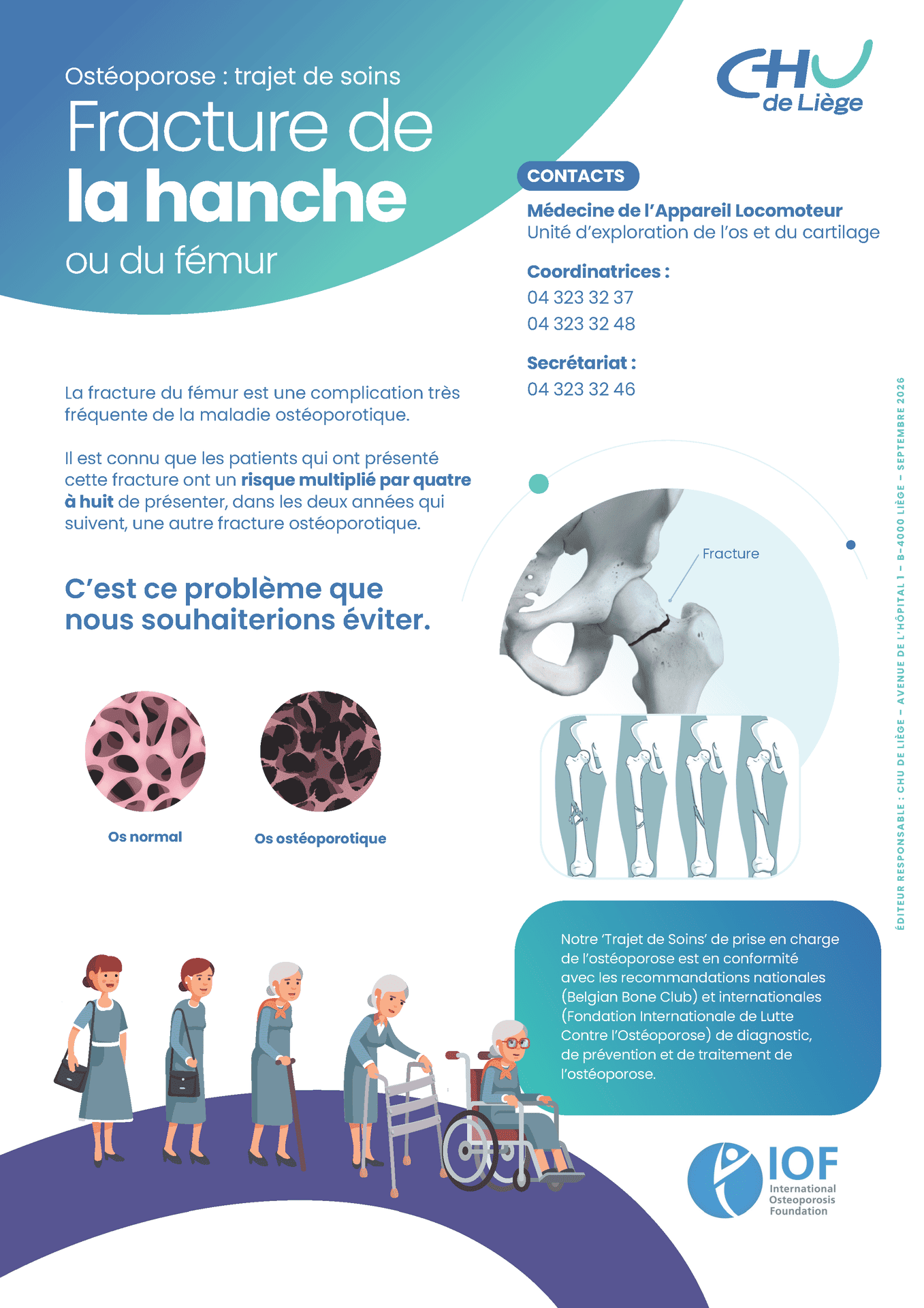 A4 MedecineAppareilLocomoteur Osteoporose FractureHanch COMPRESS